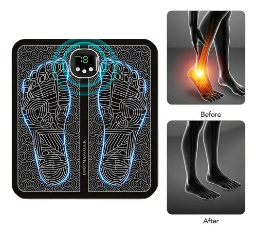 FootLuxe™ – Masajeador Eléctrico Premium